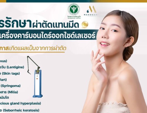 การรักษาผ่าตัดแทนมีดด้วยเครื่องคาร์บอนไดร์ออกไซด์เลเซอร์