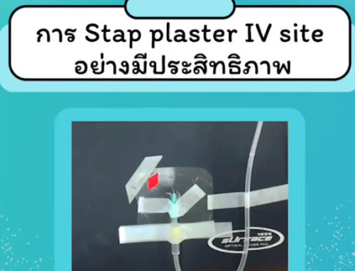 การ Stap plaster IV site อย่างมีประสิทธิภาพ