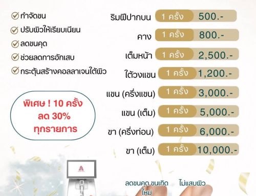 เลเซอร์กำจัดขน Diode Laser Hair Removal